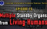 Episode 15: One Organ Transplants with Multiple Standby Donors