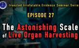 Episode 27: The Actual Organ Transplant Scale