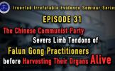 Episode 31: The Chinese Communist Party Severs Limb Tendons of Falun Gong Practitioners before Harvesting Their Organs Alive